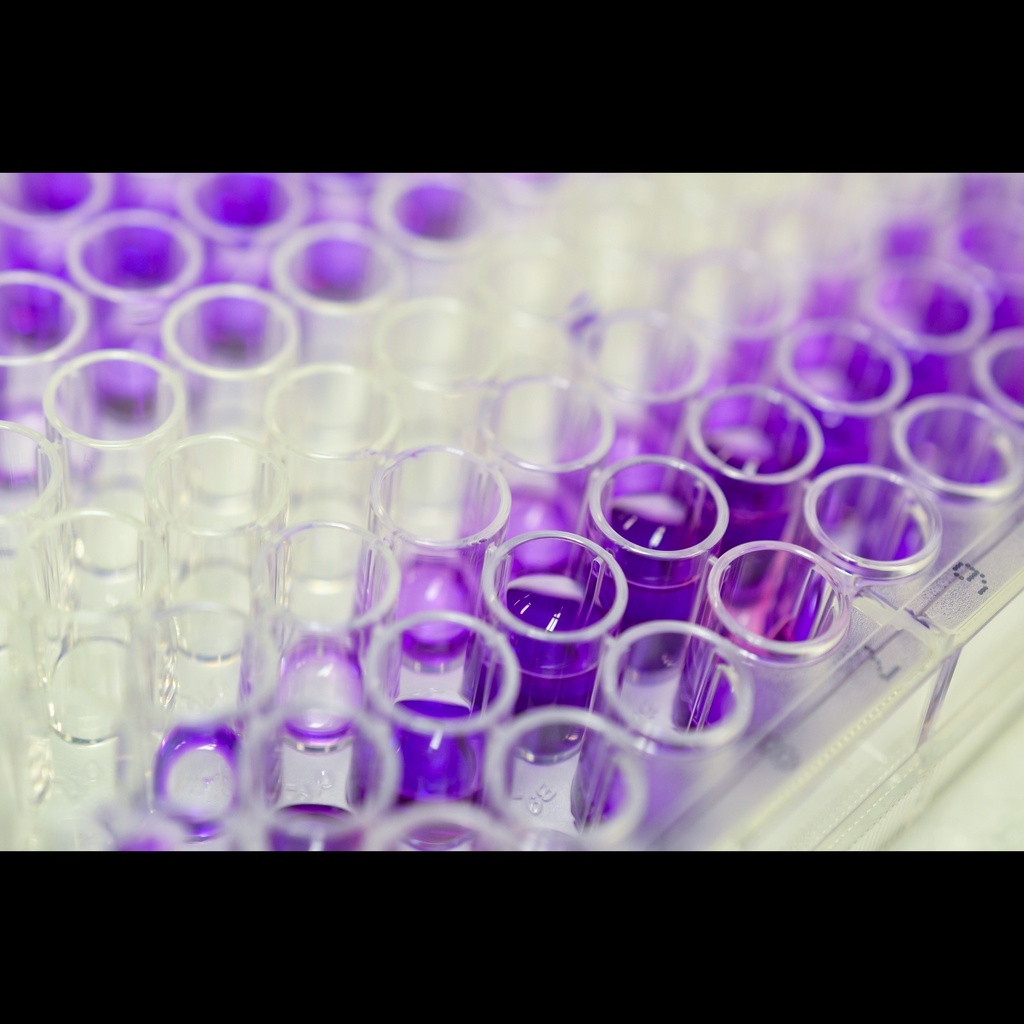 17-Beta Estradiol E2, ELISA